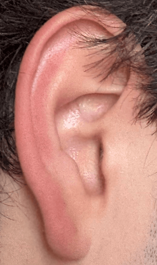 Ear